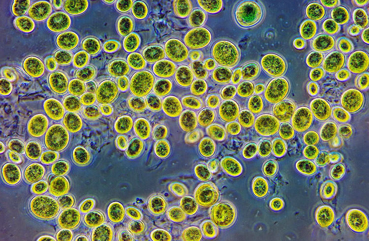 хлорелла под микроскопом